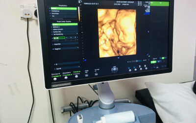 4D Ultrasound Is Changing How We Monitor Fetal Development