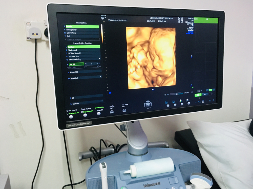 4d Ultrasound Is Changing How We Monitor Fetal Development Acertara