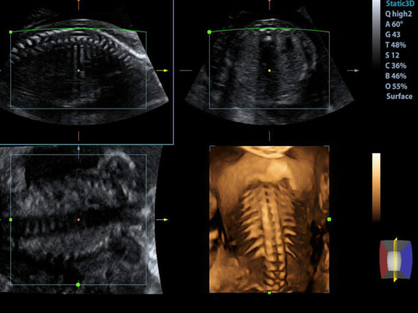 4d-ultrasound-system-benefits