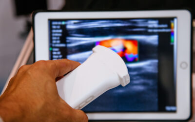 AI for Ultrasound: Improving Diagnostics and Patient Outcomes
