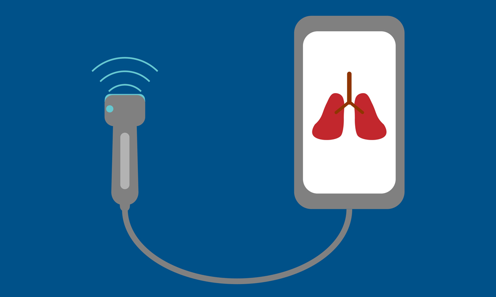 Point of Care Ultrasound Technology (POCUS) With AI