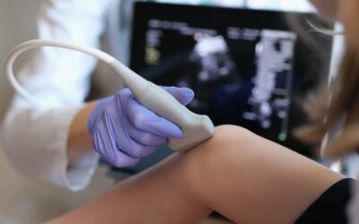 The Role of AI in Ultrasound