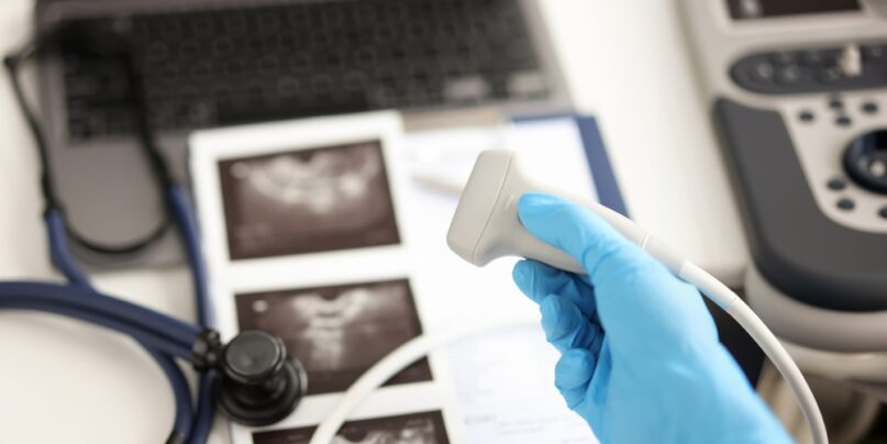 Doctor Holding Ultrasound Probe