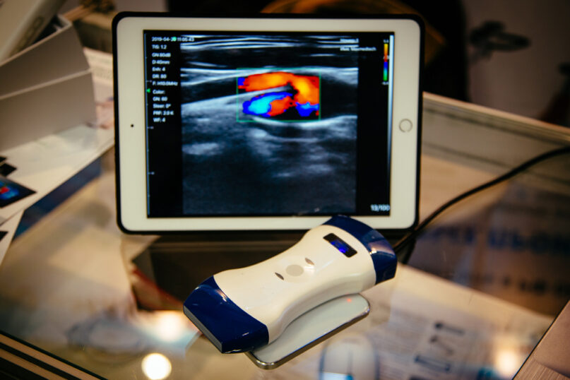 Modern Portable Ultrasound Machine