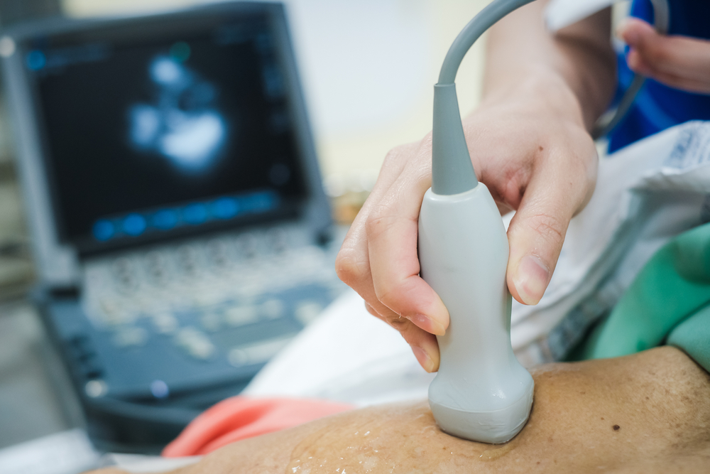 Doctor Is Examining Heart's Patient By Echocardiogram For Diagnosis Disease