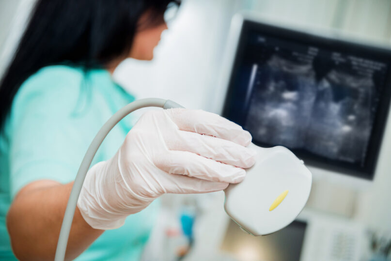 Ultrasound Scanner In The Hands Of A Doctor. Diagnostics. Sonography.